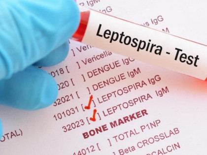 Šta je leptospiroza i kako se zaštititi: Sve što treba da znate