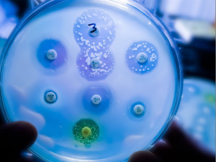 Mpoks virus može da inficira i ljudski mozak?