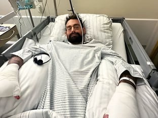Отац петоро дјеце за један дан изгубио ноге и прсте: Све је почело током одмора