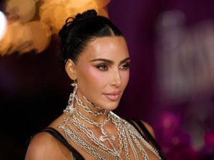 Kim Kardašijan otkrila da ima aneurizmu mozga