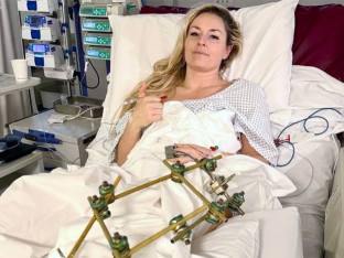 Lindzi Von otpuštena iz italijanske bolnice, četvrta operacija uspješna