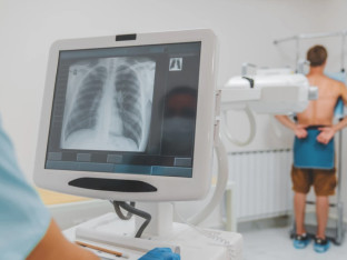 Eksperimentalni kineski lijek bolji od standardne terapije raka pluća