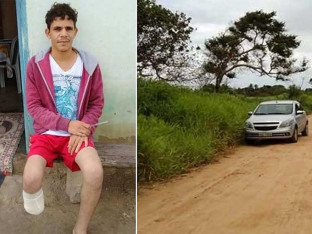 Odsjekao sebi stopalo zbog osiguranja: Nevjerovatna prevara šokirala Brazil