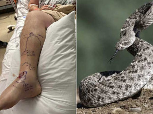 Muškarac jedva preživio višestruki ujed zvečarke, trebalo mu 54 doze protivotrova