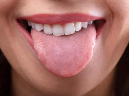Промјене на језику које не смијете игнорисати: Могу указивати на озбиљне болести