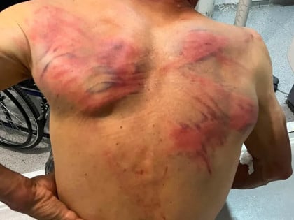 Tzv. kosovska policija pretukla Nenada Raškovića