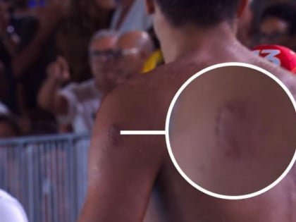 Incident na MI: Italijan ugrizao Crnogorca