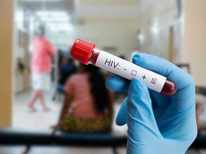 Ruski naučnici otkrili novi lijek: Umanjuje HIV za 100.000 puta!
