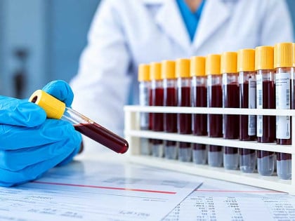 Najređa krv na planeti: Manje od 50 ljudi ima ovu medicinsku rijetkost