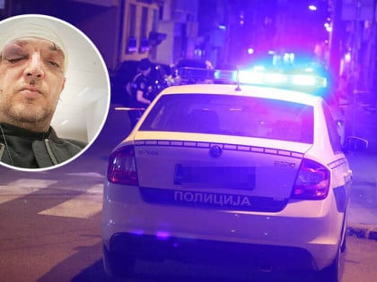Zoran Marjanović pretučen zbog 20 godina mlađe djevojke?