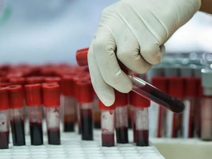 Novi čip može da ulovi ćelije raka: Rezultat za svega 20 minuta iz nekoliko mililitara krvi