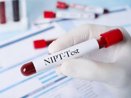 Fond zdravstvenog osiguranja: Pojednostavljena  procedura za NIPT test